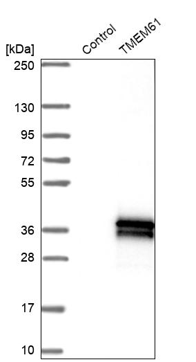 Western blot analysis in control (vector only transfected HEK293T lysate) and TMEM61 over-expression lysate (Co-expressed with a C-terminal myc-DDK tag (~3.1 kDa) in mammalian HEK293T cells, LY405509). Western blot analysis in control (vector only transfected HEK293T lysate) and TMEM61 over-expression lysate (Co-expressed with a C-terminal myc-DDK tag (~3.1 kDa) in mammalian HEK293T cells, LY405509).