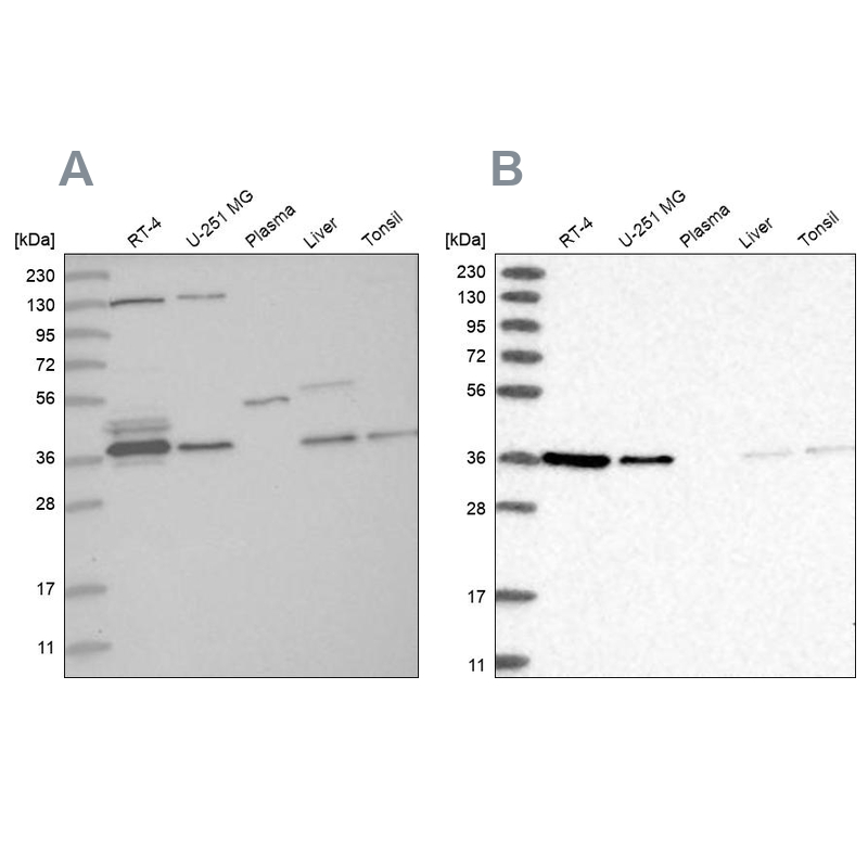 Western blot analysis using Anti-VTA1 antibody HPA030968 (A) shows similar pattern to independent antibody HPA030969 (B). Western blot analysis using Anti-VTA1 antibody HPA030968 (A) shows similar pattern to independent antibody HPA030969 (B).