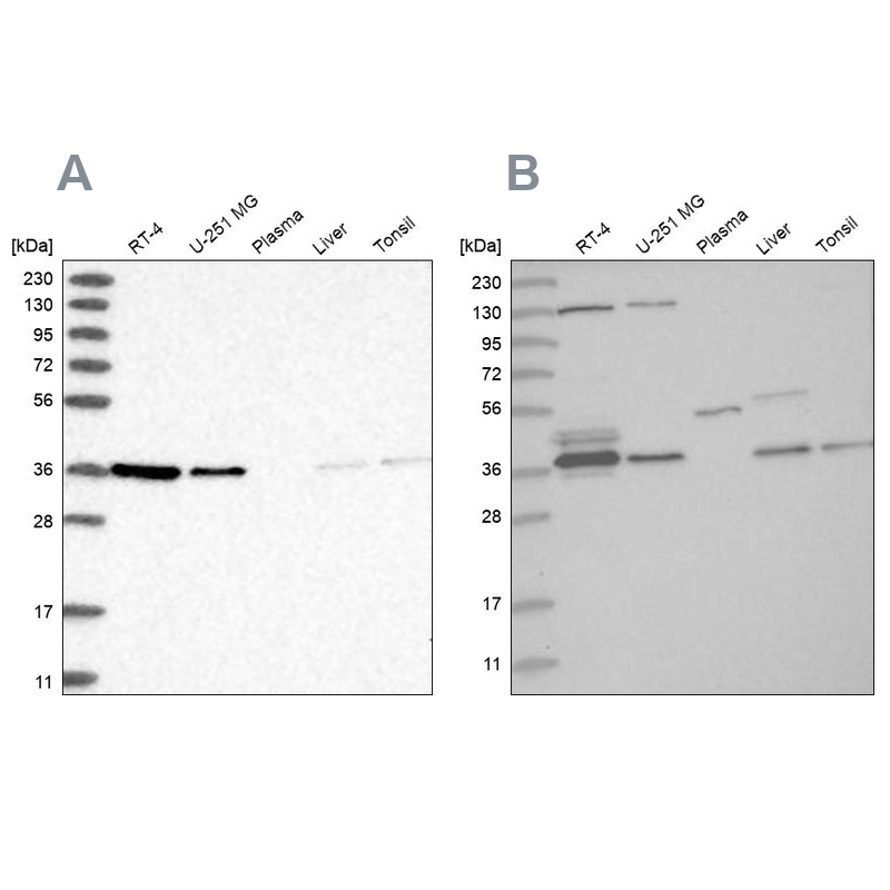 Western blot analysis using Anti-VTA1 antibody HPA030969 (A) shows similar pattern to independent antibody HPA030968 (B). Western blot analysis using Anti-VTA1 antibody HPA030969 (A) shows similar pattern to independent antibody HPA030968 (B).