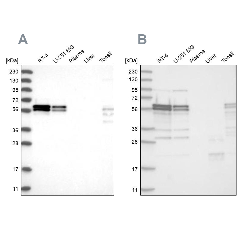 Western blot analysis using Anti-ZC3H15 antibody HPA031100 (A) shows similar pattern to independent antibody HPA031101 (B). Western blot analysis using Anti-ZC3H15 antibody HPA031100 (A) shows similar pattern to independent antibody HPA031101 (B).