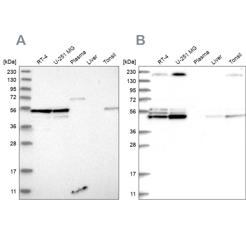 Western blot analysis using Anti-BYSL antibody HPA031217 (A) shows similar pattern to independent antibody HPA031219 (B). Western blot analysis using Anti-BYSL antibody HPA031217 (A) shows similar pattern to independent antibody HPA031219 (B).