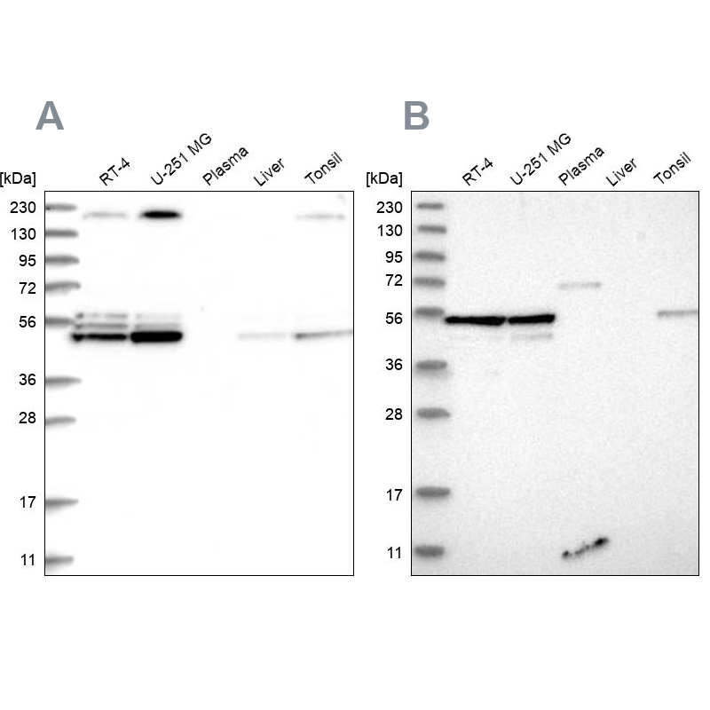 Western blot analysis using Anti-BYSL antibody HPA031219 (A) shows similar pattern to independent antibody HPA031217 (B). Western blot analysis using Anti-BYSL antibody HPA031219 (A) shows similar pattern to independent antibody HPA031217 (B).