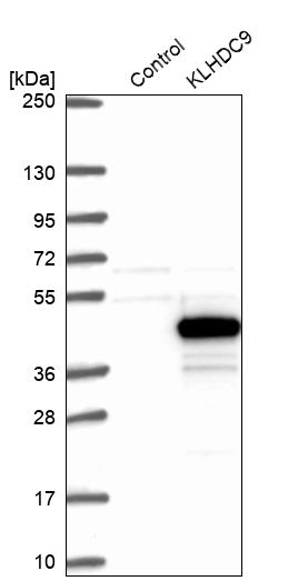 Western blot analysis in control (vector only transfected HEK293T lysate) and KLHDC9 over-expression lysate (Co-expressed with a C-terminal myc-DDK tag (~3.1 kDa) in mammalian HEK293T cells, LY407615). Western blot analysis in control (vector only transfected HEK293T lysate) and KLHDC9 over-expression lysate (Co-expressed with a C-terminal myc-DDK tag (~3.1 kDa) in mammalian HEK293T cells, LY407615).