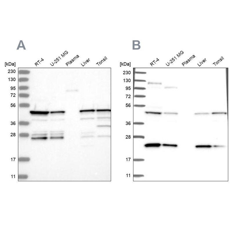 Western blot analysis using Anti-PPP1R7 antibody HPA034500 (A) shows similar pattern to independent antibody HPA034501 (B).
