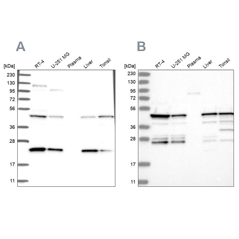 Western blot analysis using Anti-PPP1R7 antibody HPA034501 (A) shows similar pattern to independent antibody HPA034500 (B).