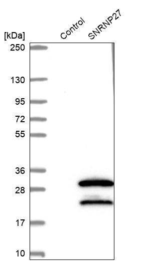 Western blot analysis in control (vector only transfected HEK293T lysate) and SNRNP27 over-expression lysate (Co-expressed with a C-terminal myc-DDK tag (~3.1 kDa) in mammalian HEK293T cells, LY416350). Western blot analysis in control (vector only transfected HEK293T lysate) and SNRNP27 over-expression lysate (Co-expressed with a C-terminal myc-DDK tag (~3.1 kDa) in mammalian HEK293T cells, LY416350).