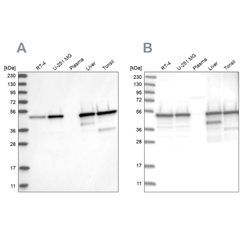 Western blot analysis using Anti-TXNDC5 antibody HPA034677 (A) shows similar pattern to independent antibody HPA034678 (B). Western blot analysis using Anti-TXNDC5 antibody HPA034677 (A) shows similar pattern to independent antibody HPA034678 (B).