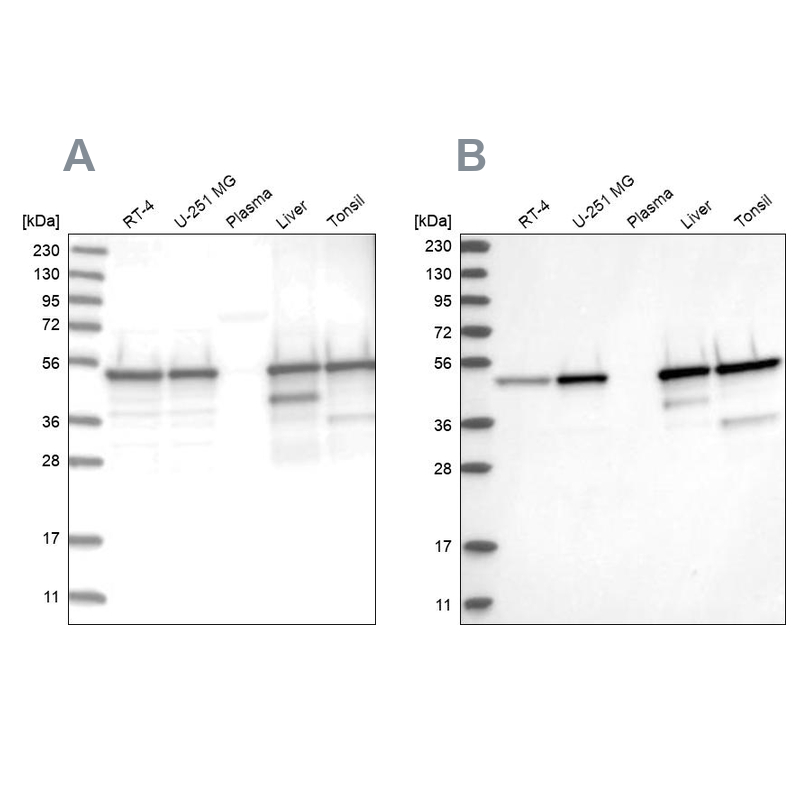 Western blot analysis using Anti-TXNDC5 antibody HPA034678 (A) shows similar pattern to independent antibody HPA034677 (B).