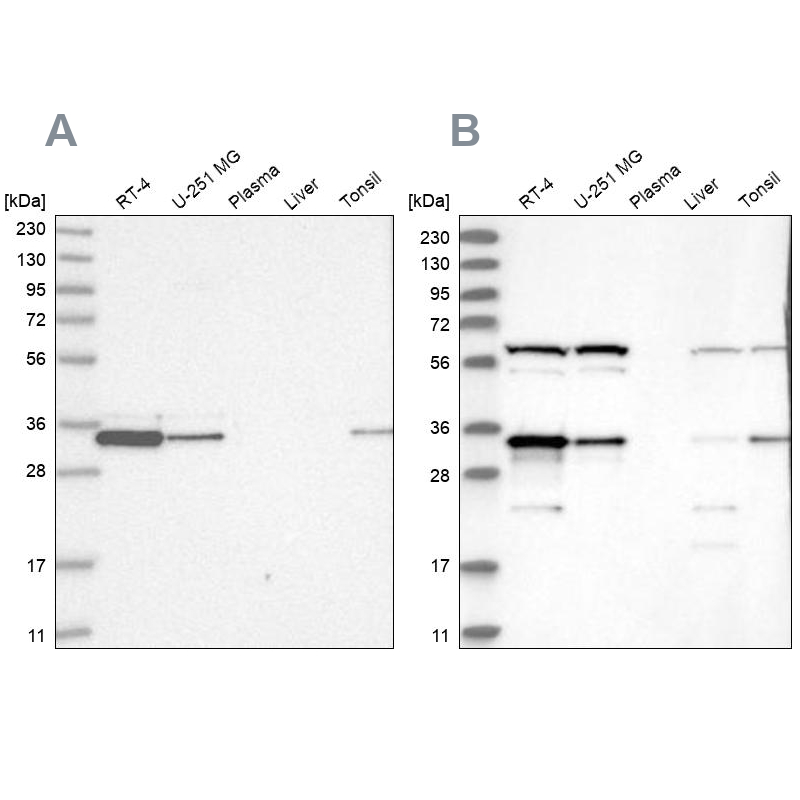 Western blot analysis using Anti-PRKRA antibody HPA034996 (A) shows similar pattern to independent antibody HPA034997 (B).