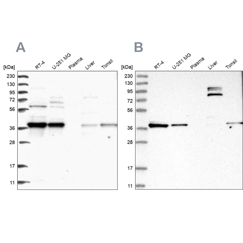 Western blot analysis using Anti-TBCC antibody HPA035074 (A) shows similar pattern to independent antibody HPA035073 (B).