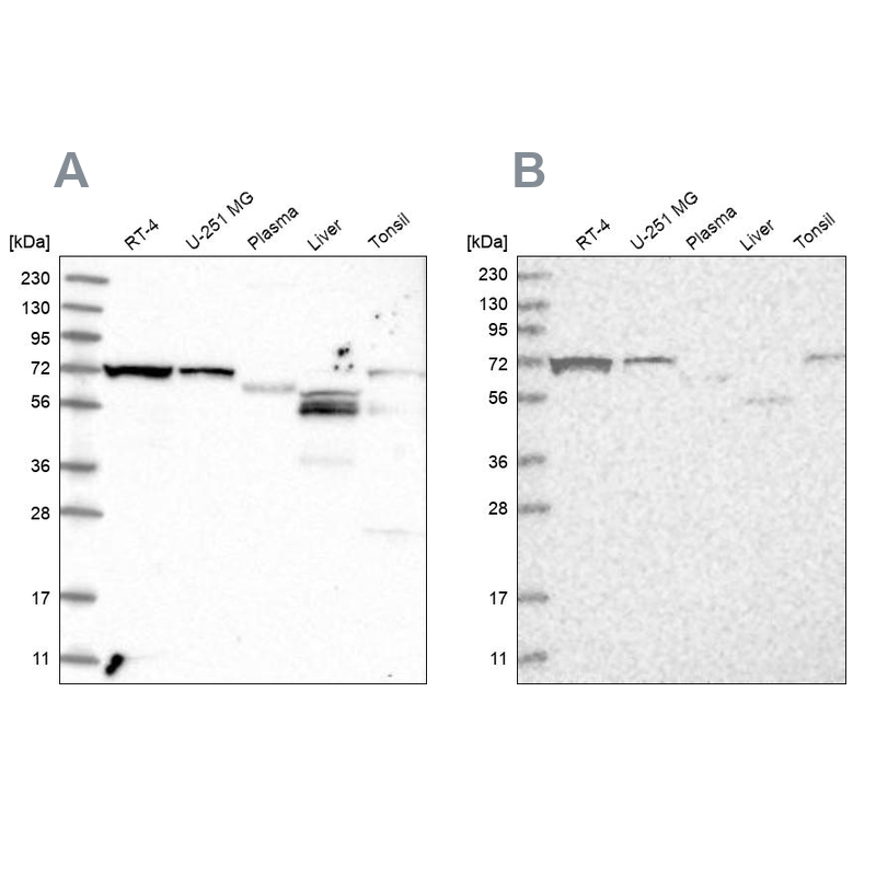 Western blot analysis using Anti-SLC25A12 antibody HPA035333 (A) shows similar pattern to independent antibody HPA035334 (B).