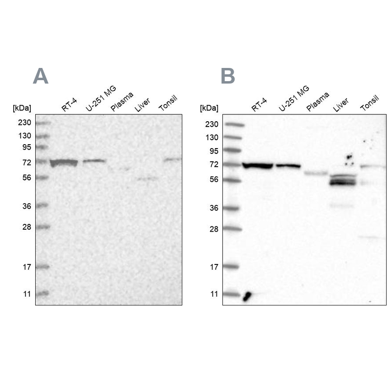 Western blot analysis using Anti-SLC25A12 antibody HPA035334 (A) shows similar pattern to independent antibody HPA035333 (B).