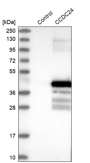 Western blot analysis in control (vector only transfected HEK293T lysate) and CCDC24 over-expression lysate (Co-expressed with a C-terminal myc-DDK tag (~3.1 kDa) in mammalian HEK293T cells, LY407505). Western blot analysis in control (vector only transfected HEK293T lysate) and CCDC24 over-expression lysate (Co-expressed with a C-terminal myc-DDK tag (~3.1 kDa) in mammalian HEK293T cells, LY407505).