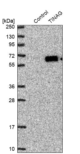Western blot analysis in control (vector only transfected HEK293T lysate) and TINAG over-expression lysate (Co-expressed with a C-terminal myc-DDK tag (~3.1 kDa) in mammalian HEK293T cells, LY402341). Western blot analysis in control (vector only transfected HEK293T lysate) and TINAG over-expression lysate (Co-expressed with a C-terminal myc-DDK tag (~3.1 kDa) in mammalian HEK293T cells, LY402341).