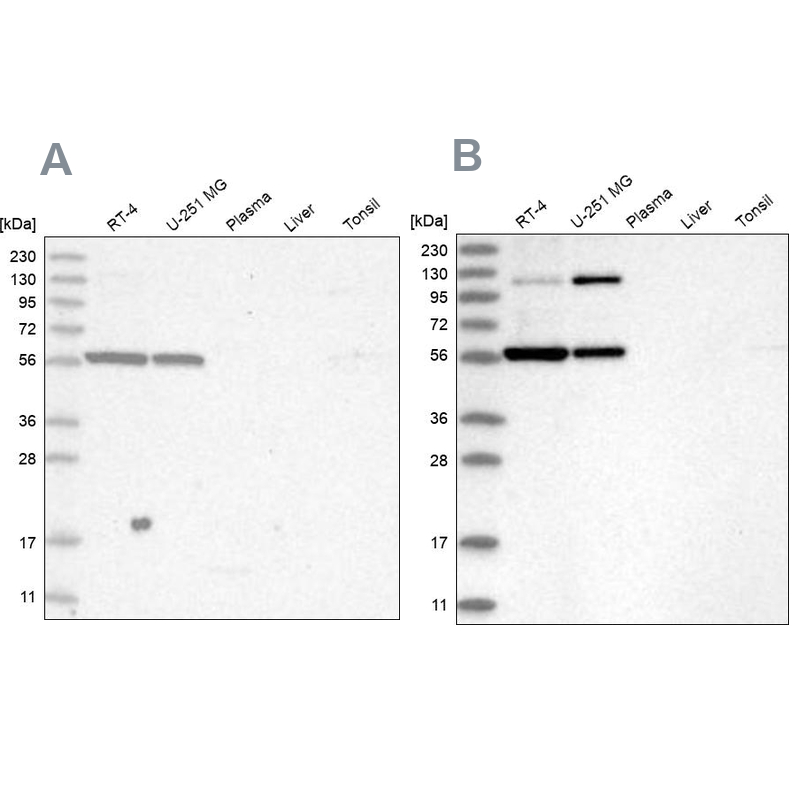 Western blot analysis using Anti-PLRG1 antibody HPA035932 (A) shows similar pattern to independent antibody HPA035931 (B).