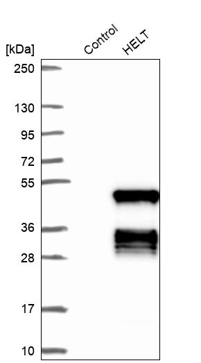 Western blot analysis in control (vector only transfected HEK293T lysate) and HELT over-expression lysate (Co-expressed with a C-terminal myc-DDK tag (~3.1 kDa) in mammalian HEK293T cells, LY422265).