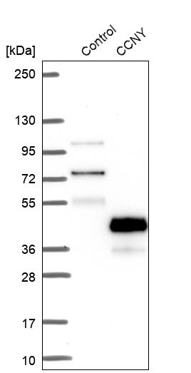 Western blot analysis in control (vector only transfected HEK293T lysate) and CCNY over-expression lysate (Co-expressed with a C-terminal myc-DDK tag (~3.1 kDa) in mammalian HEK293T cells, LY408148).