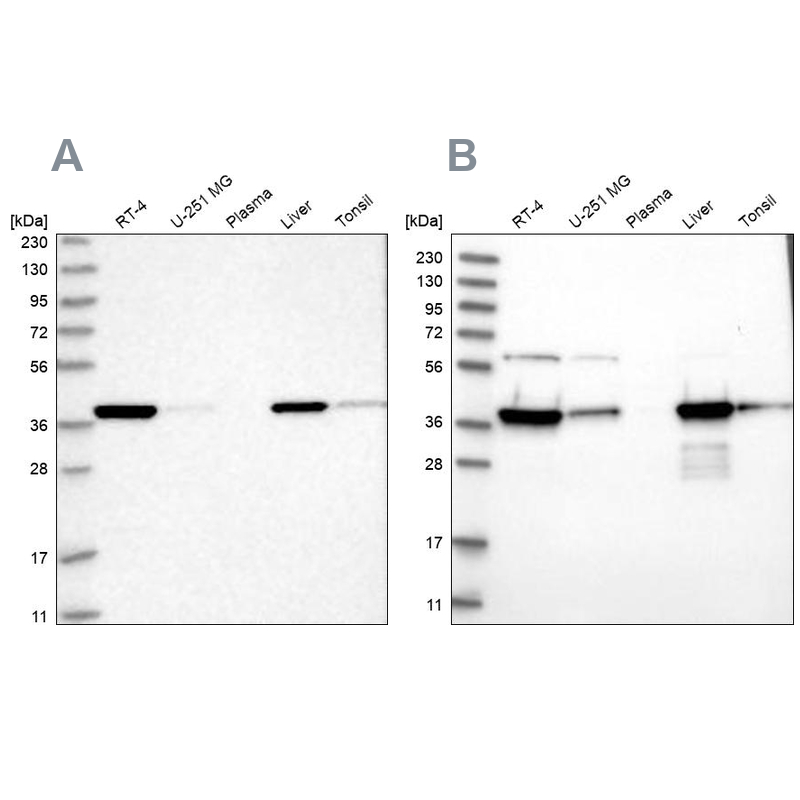 Western blot analysis using Anti-HIBCH antibody HPA036540 (A) shows similar pattern to independent antibody HPA036541 (B). Western blot analysis using Anti-HIBCH antibody HPA036540 (A) shows similar pattern to independent antibody HPA036541 (B).