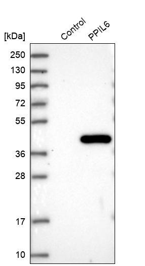 Western blot analysis in control (vector only transfected HEK293T lysate) and PPIL6 over-expression lysate (Co-expressed with a C-terminal myc-DDK tag (~3.1 kDa) in mammalian HEK293T cells, LY406551).