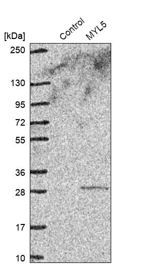 Western blot analysis in control (vector only transfected HEK293T lysate) and MYL5 over-expression lysate (Co-expressed with a C-terminal myc-DDK tag (~3.1 kDa) in mammalian HEK293T cells, LY419312). Western blot analysis in control (vector only transfected HEK293T lysate) and MYL5 over-expression lysate (Co-expressed with a C-terminal myc-DDK tag (~3.1 kDa) in mammalian HEK293T cells, LY419312).