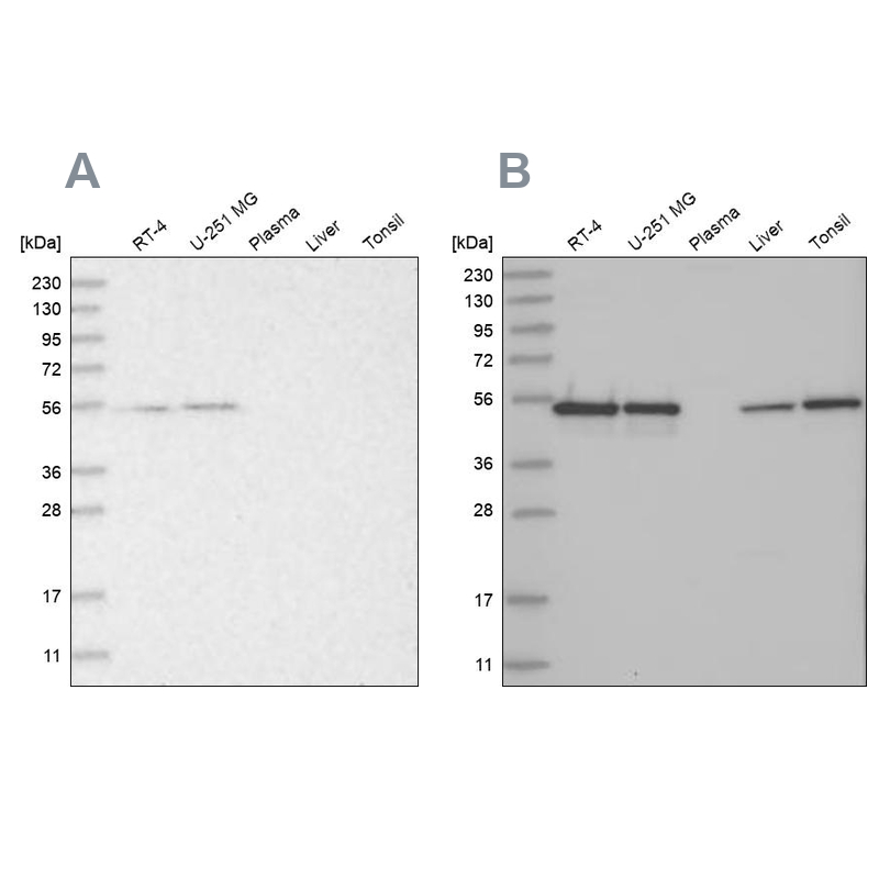 Western blot analysis using Anti-RBM17 antibody HPA037477 (A) shows similar pattern to independent antibody HPA037478 (B).