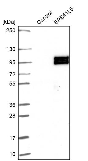 Western blot analysis in control (vector only transfected HEK293T lysate) and EPB41L5 over-expression lysate (Co-expressed with a C-terminal myc-DDK tag (~3.1 kDa) in mammalian HEK293T cells, LY412211).