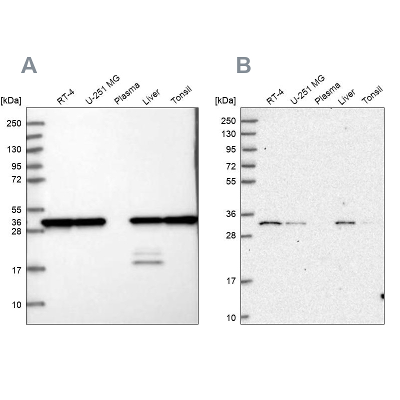 Western blot analysis using Anti-PSMA1 antibody HPA037646 (A) shows similar pattern to independent antibody HPA043891 (B).