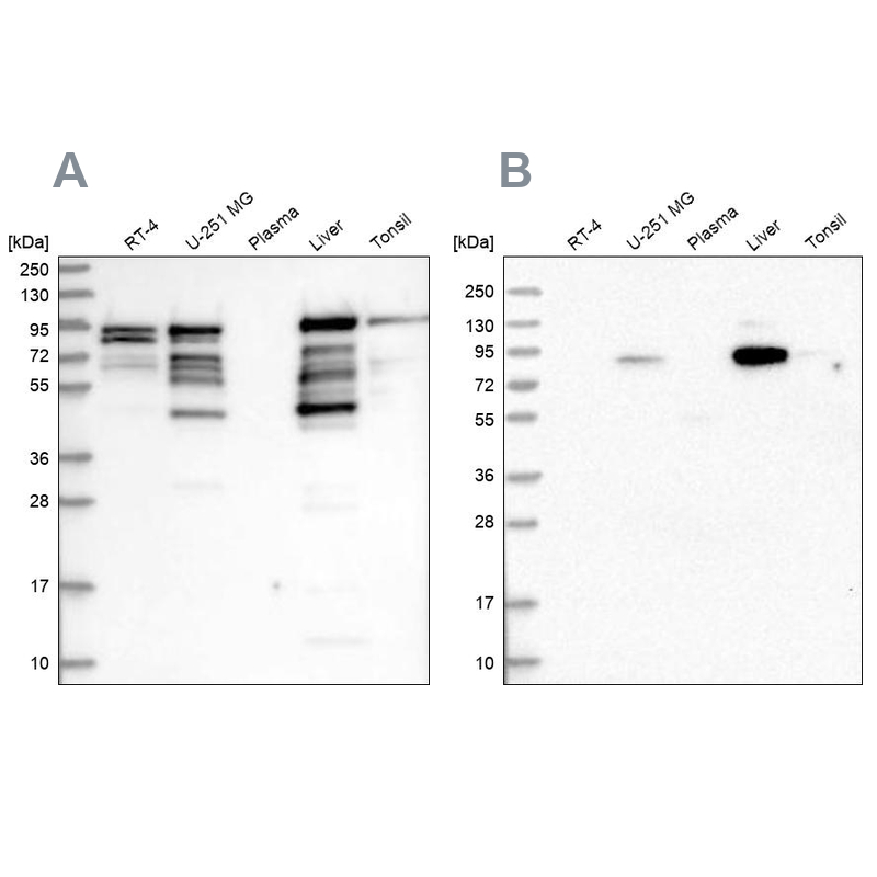 Western blot analysis using Anti-SHTN1 antibody HPA037943 (A) shows similar pattern to independent antibody HPA037942 (B).