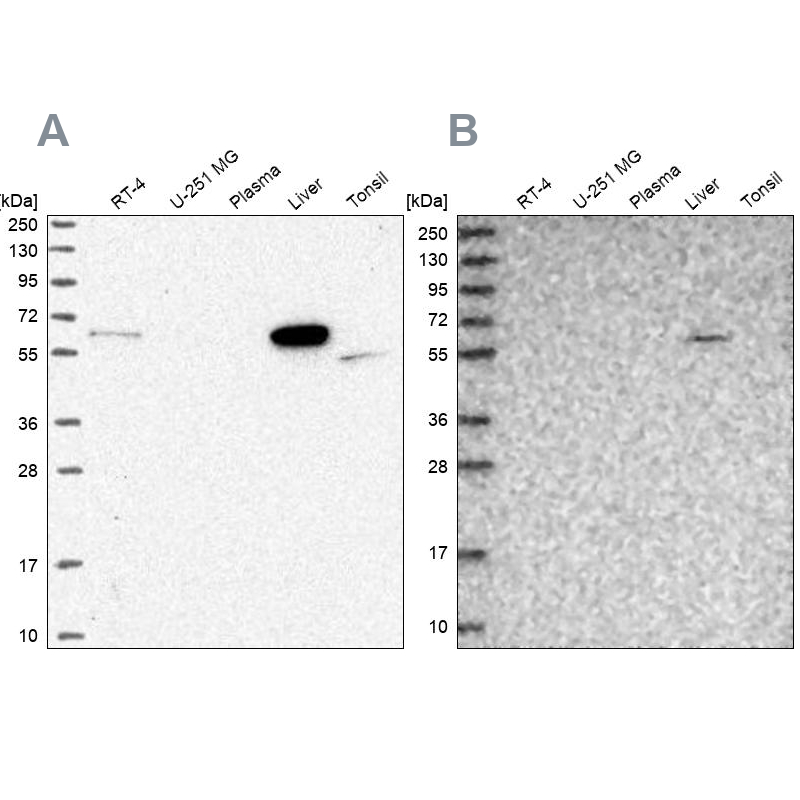Western blot analysis using Anti-SUOX antibody HPA038208 (A) shows similar pattern to independent antibody HPA038209 (B). Western blot analysis using Anti-SUOX antibody HPA038208 (A) shows similar pattern to independent antibody HPA038209 (B).