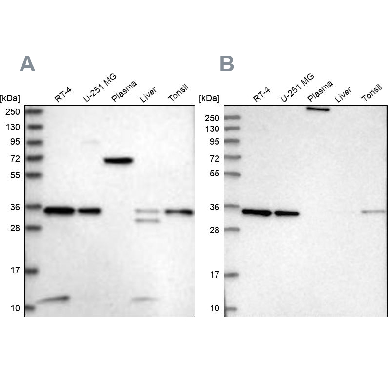 Western blot analysis using Anti-VPS37B antibody HPA038217 (A) shows similar pattern to independent antibody HPA038218 (B). Western blot analysis using Anti-VPS37B antibody HPA038217 (A) shows similar pattern to independent antibody HPA038218 (B).
