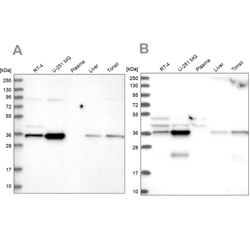 Western blot analysis using Anti-GPATCH11 antibody HPA038231 (A) shows similar pattern to independent antibody HPA038232 (B).
