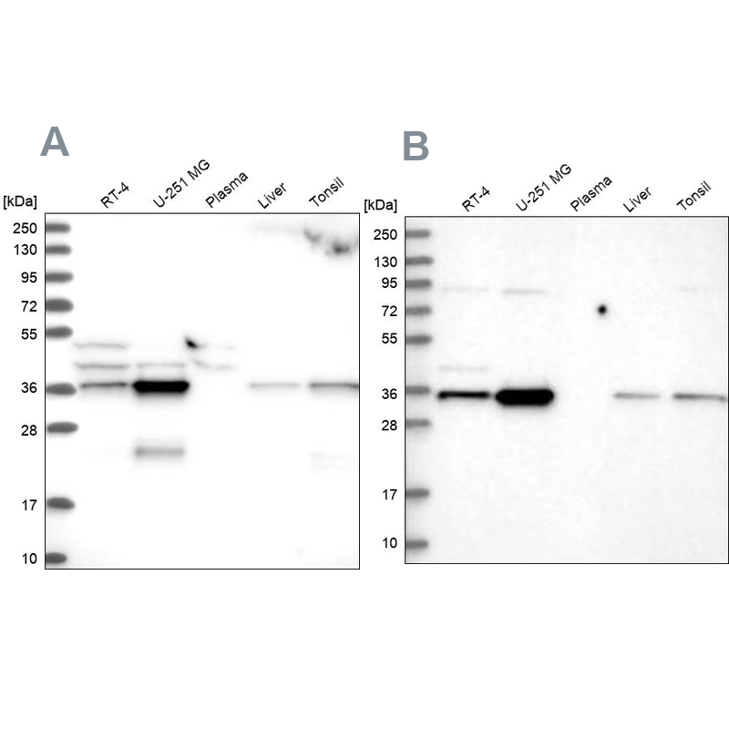 Western blot analysis using Anti-GPATCH11 antibody HPA038232 (A) shows similar pattern to independent antibody HPA038231 (B).