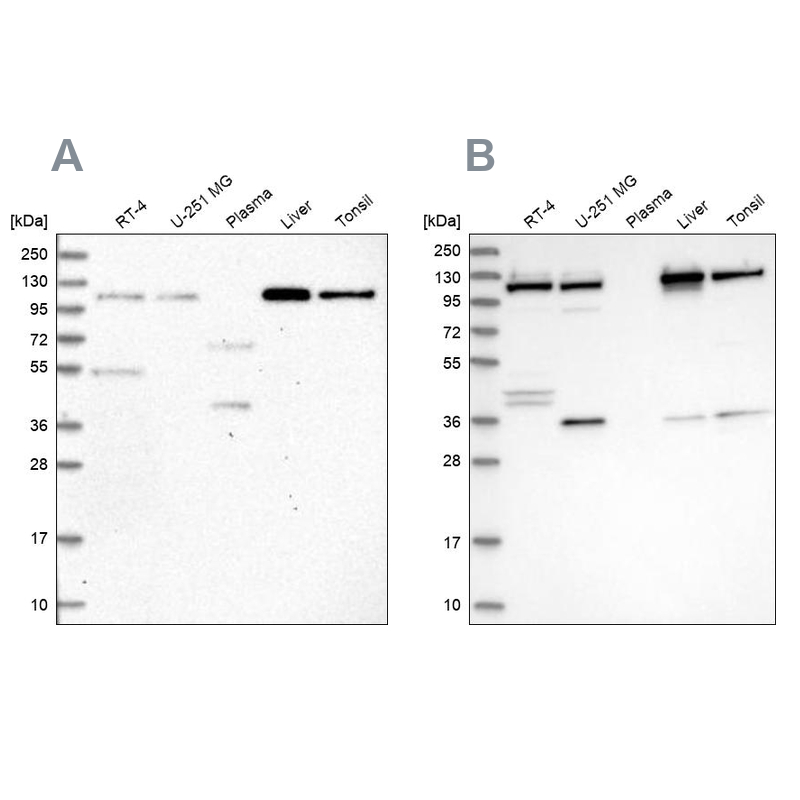 Western blot analysis using Anti-USO1 antibody HPA038282 (A) shows similar pattern to independent antibody HPA038283 (B).