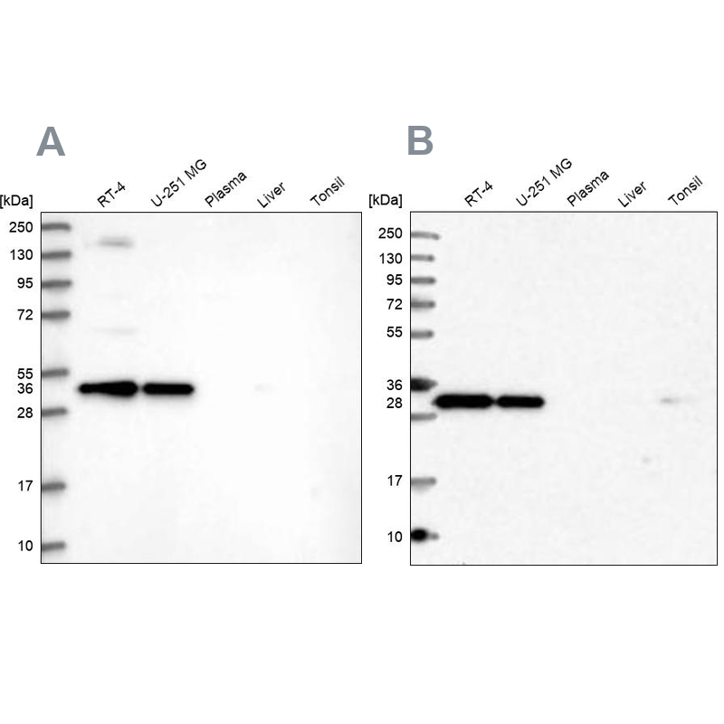 Western blot analysis using Anti-STX6 antibody HPA038557 (A) shows similar pattern to independent antibody HPA038558 (B).