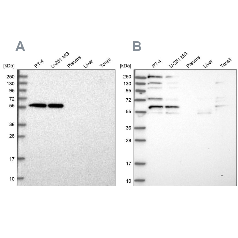Western blot analysis using Anti-SAAL1 antibody HPA039003 (A) shows similar pattern to independent antibody HPA039004 (B). Western blot analysis using Anti-SAAL1 antibody HPA039003 (A) shows similar pattern to independent antibody HPA039004 (B).