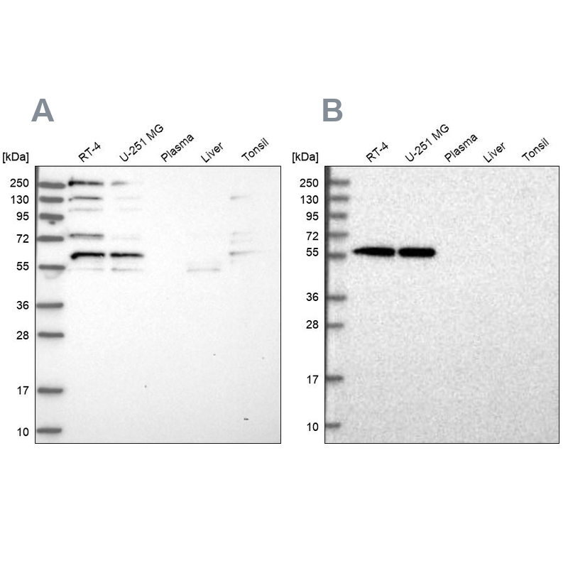 Western blot analysis using Anti-SAAL1 antibody HPA039004 (A) shows similar pattern to independent antibody HPA039003 (B).