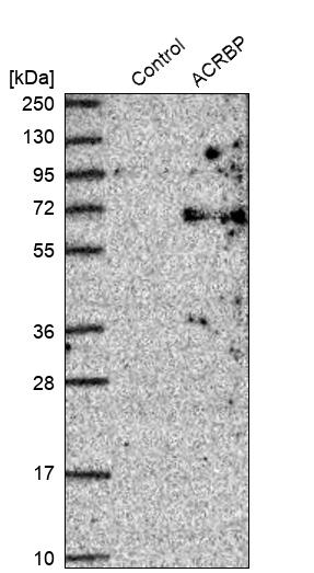 Western blot analysis in control (vector only transfected HEK293T lysate) and ACRBP over-expression lysate (Co-expressed with a C-terminal myc-DDK tag (~3.1 kDa) in mammalian HEK293T cells, LY403164). Western blot analysis in control (vector only transfected HEK293T lysate) and ACRBP over-expression lysate (Co-expressed with a C-terminal myc-DDK tag (~3.1 kDa) in mammalian HEK293T cells, LY403164).