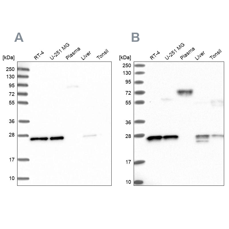 Western blot analysis using Anti-MESDC2 antibody HPA039414 (A) shows similar pattern to independent antibody HPA041721 (B). Western blot analysis using Anti-MESDC2 antibody HPA039414 (A) shows similar pattern to independent antibody HPA041721 (B).