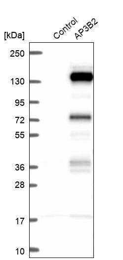 Western blot analysis in control (vector only transfected HEK293T lysate) and AP3B2 over-expression lysate (Co-expressed with a C-terminal myc-DDK tag (~3.1 kDa) in mammalian HEK293T cells, LY401473). Western blot analysis in control (vector only transfected HEK293T lysate) and AP3B2 over-expression lysate (Co-expressed with a C-terminal myc-DDK tag (~3.1 kDa) in mammalian HEK293T cells, LY401473).