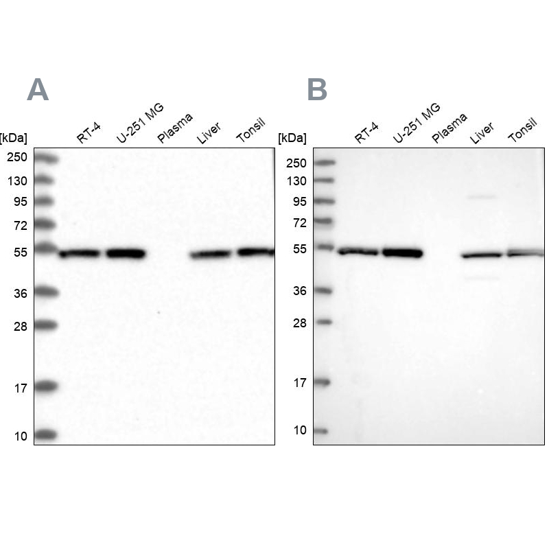 Western blot analysis using Anti-DCTN2 antibody HPA039715 (A) shows similar pattern to independent antibody HPA040040 (B).
