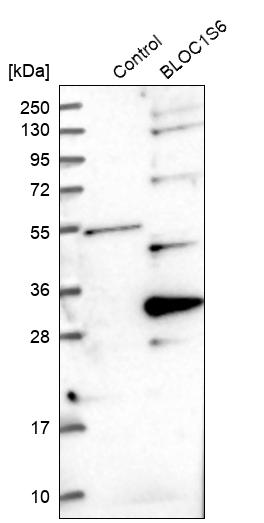 Western blot analysis in control (vector only transfected HEK293T lysate) and BLOC1S6 over-expression lysate (Co-expressed with a C-terminal myc-DDK tag (~3.1 kDa) in mammalian HEK293T cells, LY402203).