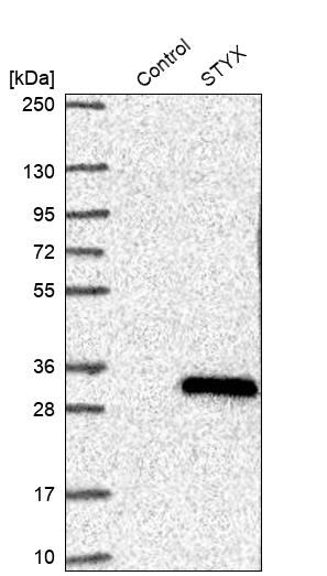 Western blot analysis in control (vector only transfected HEK293T lysate) and STYX over-expression lysate (Co-expressed with a C-terminal myc-DDK tag (~3.1 kDa) in mammalian HEK293T cells, LY407985). Western blot analysis in control (vector only transfected HEK293T lysate) and STYX over-expression lysate (Co-expressed with a C-terminal myc-DDK tag (~3.1 kDa) in mammalian HEK293T cells, LY407985).