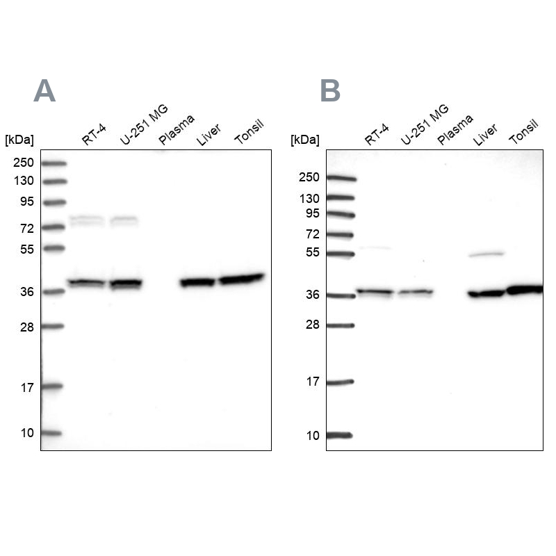 Western blot analysis using Anti-TALDO1 antibody HPA040373 (A) shows similar pattern to independent antibody HPA048089 (B).