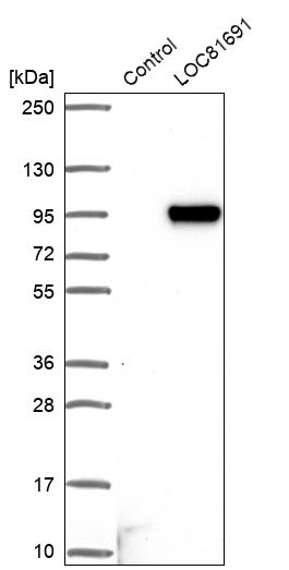 Western blot analysis in control (vector only transfected HEK293T lysate) and LOC81691 over-expression lysate (Co-expressed with a C-terminal myc-DDK tag (~3.1 kDa) in mammalian HEK293T cells, LY403099). Western blot analysis in control (vector only transfected HEK293T lysate) and LOC81691 over-expression lysate (Co-expressed with a C-terminal myc-DDK tag (~3.1 kDa) in mammalian HEK293T cells, LY403099).