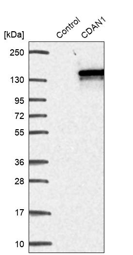 Western blot analysis in control (vector only transfected HEK293T lysate) and CDAN1 over-expression lysate (Co-expressed with a C-terminal myc-DDK tag (~3.1 kDa) in mammalian HEK293T cells, LY408581).
