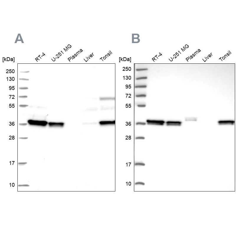 Western blot analysis using Anti-RALY antibody HPA040971 (A) shows similar pattern to independent antibody HPA043614 (B).