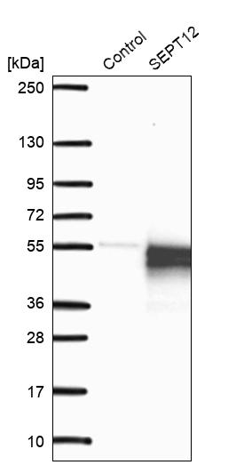 Western blot analysis in control (vector only transfected HEK293T lysate) and LY408232 over-expression lysate (Co-expressed with a C-terminal myc-DDK tag (~3.1 kDa) in mammalian HEK293T cells, LY408232).