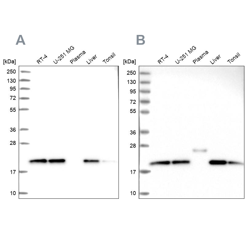 Western blot analysis using Anti-NDUFA8 antibody HPA041510 (A) shows similar pattern to independent antibody HPA041600 (B).