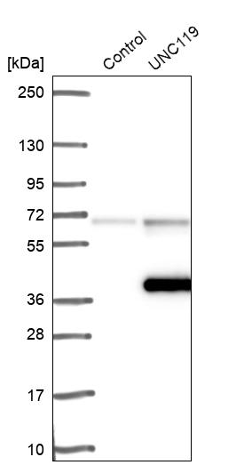 Western blot analysis in control (vector only transfected HEK293T lysate) and UNC119 over-expression lysate (Co-expressed with a C-terminal myc-DDK tag (~3.1 kDa) in mammalian HEK293T cells, LY417490). Western blot analysis in control (vector only transfected HEK293T lysate) and UNC119 over-expression lysate (Co-expressed with a C-terminal myc-DDK tag (~3.1 kDa) in mammalian HEK293T cells, LY417490).