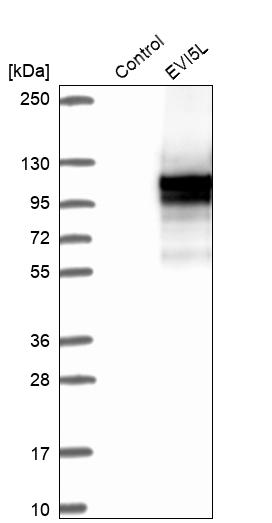 Western blot analysis in control (vector only transfected HEK293T lysate) and EVI5L over-expression lysate (Co-expressed with a C-terminal myc-DDK tag (~3.1 kDa) in mammalian HEK293T cells, LY407979).